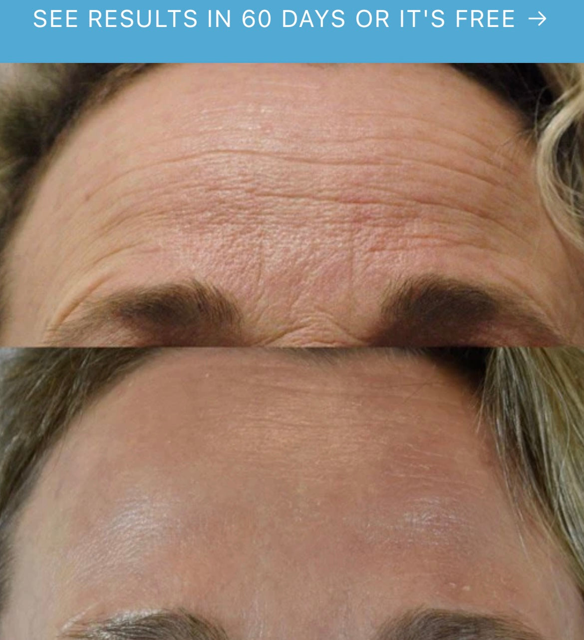 Le coffret de soins premium Dr Melaxin 