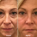 soin contour yeux anti-poches