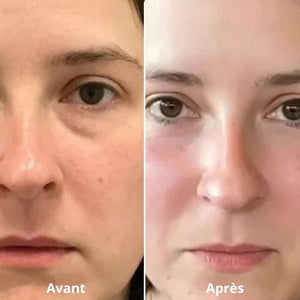 soin contour yeux anti-poches