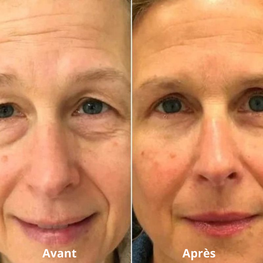 soin contour yeux anti-poches