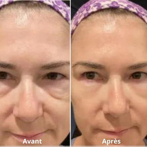soin contour yeux anti-poches